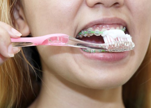 670px-Clean-Teeth-With-Braces-Step-3