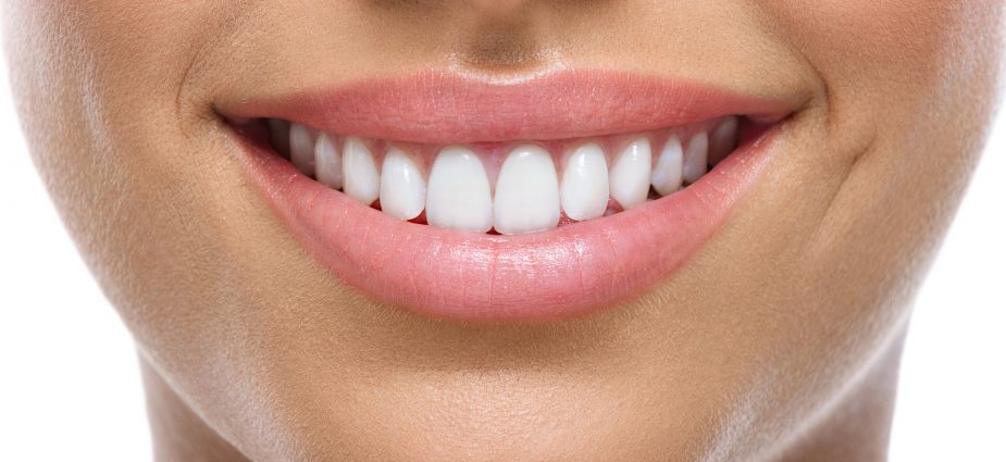 veneers, dental veneers, cosmetic dentistry, veneers, dental, teeth, cosmetic dentistry, What are the benefits of dental veneers?